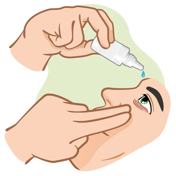 Gotas para los ojos Ilustración de medicamentos para rastrearnos ojos enojados. ideal para materiales de formación, catálogos e instituciones — Vector de stock