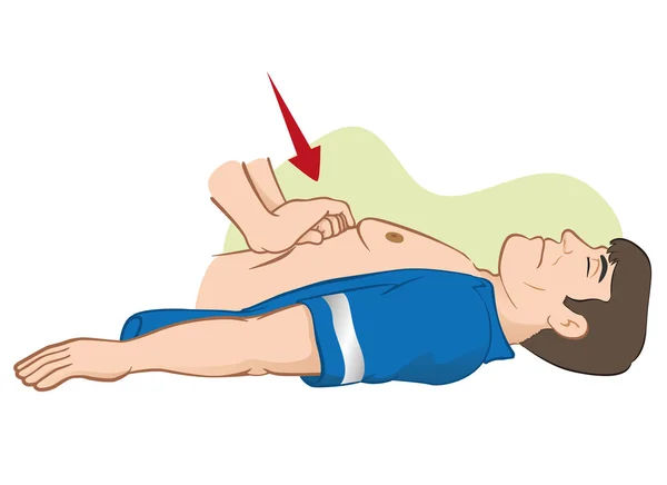 Reanimação de primeiros socorros (RCP), massagem de compressão abdominal Para reanimação. Ideal para materiais de formação, catálogos e instituições —  Vetores de Stock