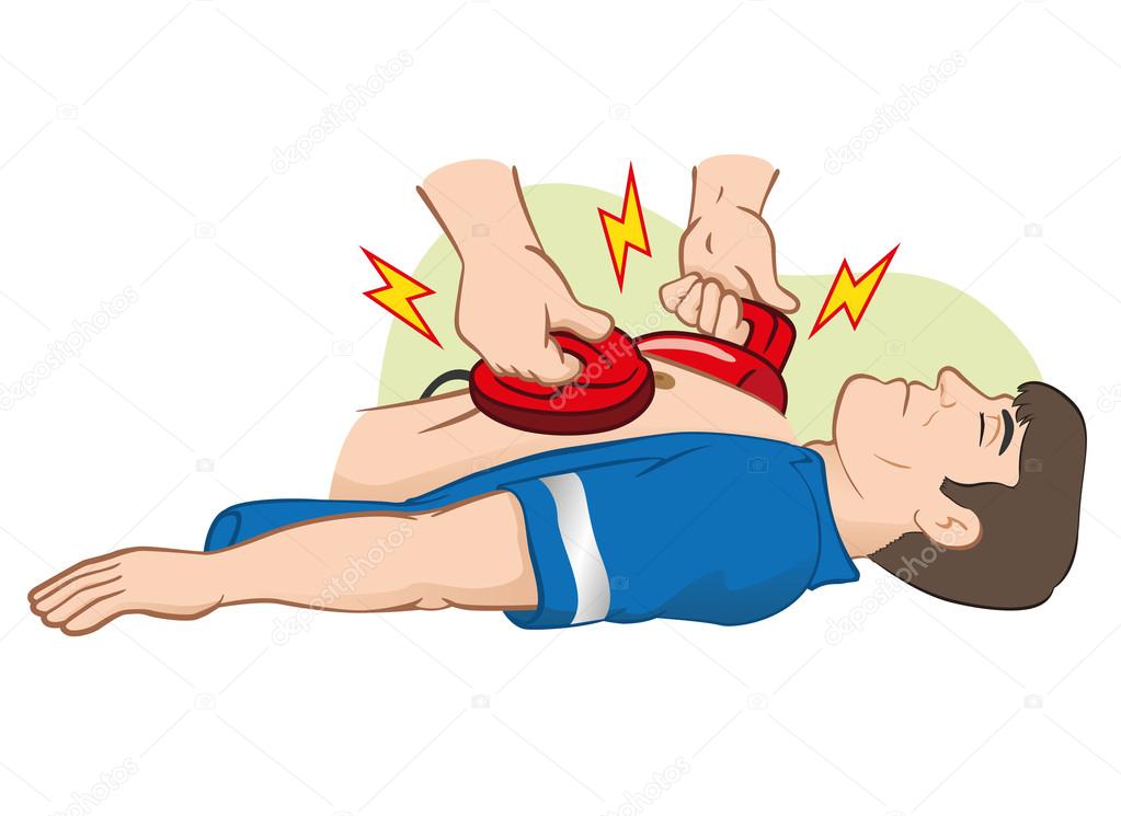 Illustration First Aid resuscitation (CPR) using defibrillator to cardiac arrest. Ideal for training materials, catalogs and institutional