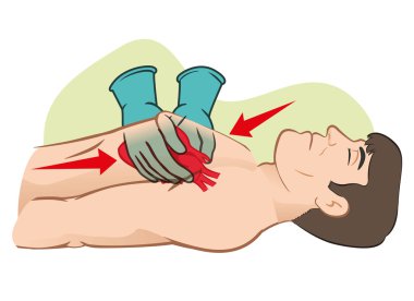 İlk yardım kalp masajı (Cpr), açık kalp masajı. Canlandırma için. Malzemeleri, eğitim kataloglar için ideal ve kurumsal