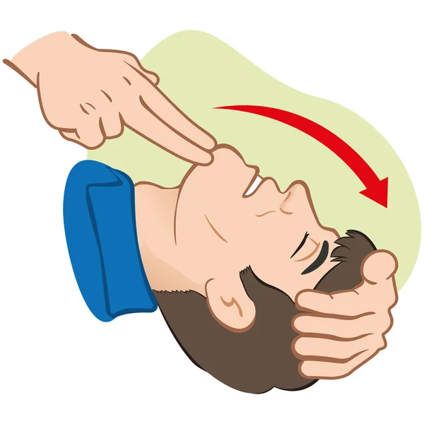 Resusitasi pertolongan pertama (CPR), membersihkan pernapasan, posisi. Untuk resusitasi. Ideal untuk bahan pelatihan, katalog dan kelembagaan - Stok Vektor