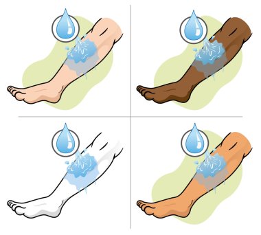 Resimde ilk yardım, alan bir bacağımı yaralı su ile yıkayın. Tıbbi malzeme, eğitim ve kurumsal için idealdir