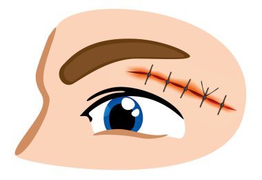 Illustration of a receiving first aid, injury or cut and sutured face. Ideal for catalogs, information and first aid guides clipart