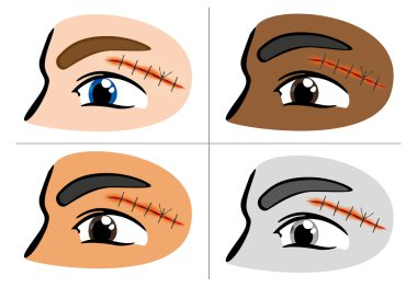 Illustration of a receiving first aid, injury or cut and sutured face. Ideal for catalogs, information and first aid guides