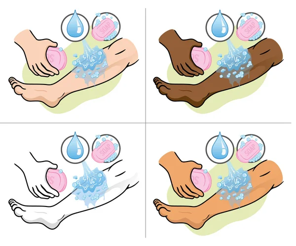 Ilustración de una pierna que recibe primeros auxilios, lavado lesionado con agua y jabón. Ideal para suministros médicos, educativos e institucionales . — Vector de stock