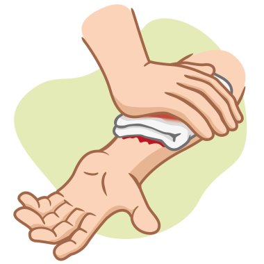 Illustration of an arm receiving first aid, injury compression arm. Ideal for medical supplies, educational and institutional clipart