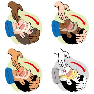 ilk yardım canlandırma (cpr), takas nefes, konumlandırma, etnais. Canlandırma için. malzemeleri, eğitim kataloglar için ideal ve kurumsal