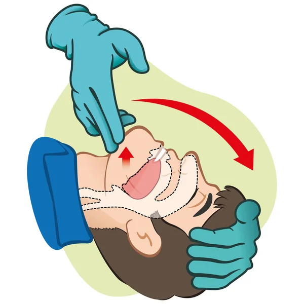 Réanimation de premiers soins (RCR), évacuation respiratoire, positionnement avec gants. Pour la réanimation. Idéal pour les matériels de formation, catalogues et institutions — Image vectorielle