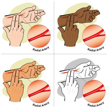 Illustration First Aid person measuring the pulse Carotid artery, ethnicities. Ideal for catalogs, informative and medical guides