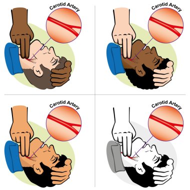 Illustration First Aid person measuring the pulse Carotid artery, ethnicities. Ideal for catalogs, informative and medical guides