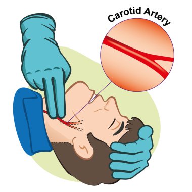 First Aid illustration person measuring pulse through the carotid artery with gloves. Ideal for catalogs, informative and medical guides