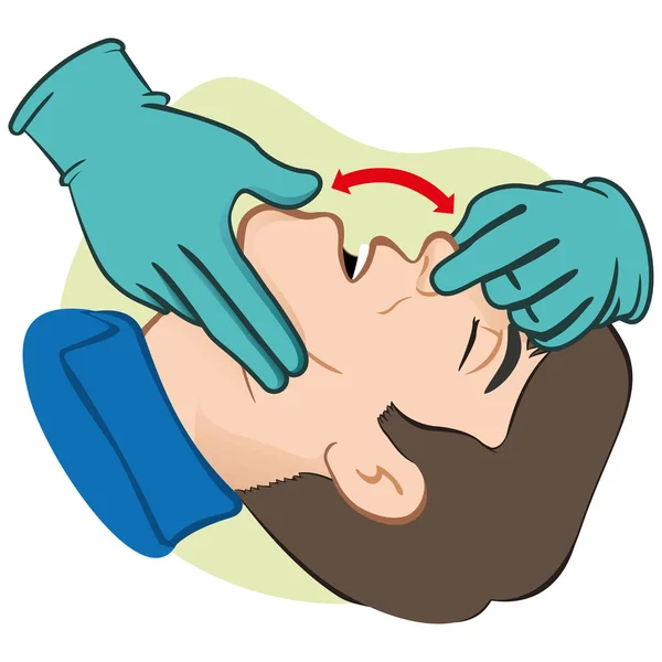 Ilustración Persona de primeros auxilios abriendo la boca limpiando las vías respiratorias con guantes. Ideal para catálogos, guías informativas y médicas — Vector de stock