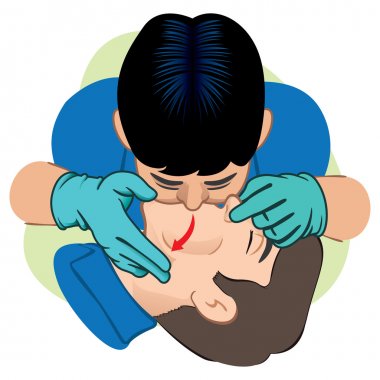 First Aid resuscitation (CPR), mouth-to-mouth resuscitation. Caucasian with gloves. For resuscitation. Ideal for training materials, catalogs and institutional