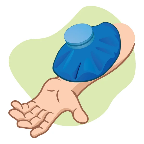 Ilustração O braço da pessoa de primeiros socorros com saco térmico. Ideal para catálogos, guias informativos e médicos — Vetor de Stock