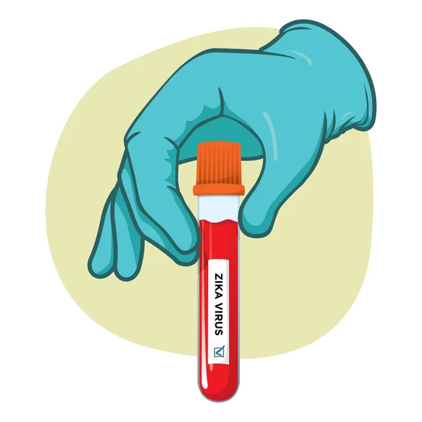 Ilustración que representa una mano que sujeta un vial de sangre al examen del virus zika, recogida en una batería de pruebas de laboratorio — Vector de stock