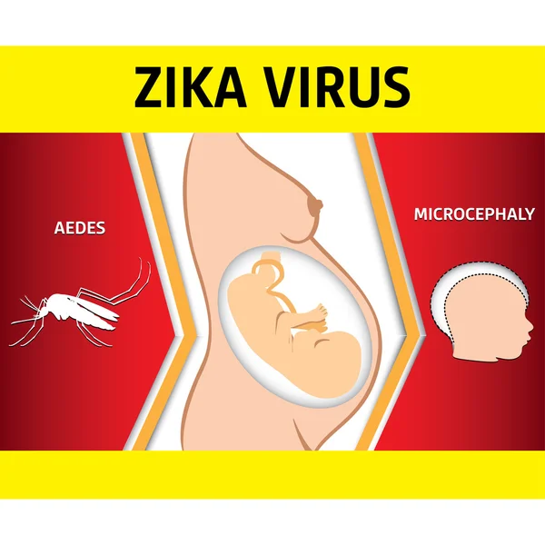 Ilustración de una embarazada con el virus del Zika y un bebé recién nacido con enfermedad por microcefalia, Aedes. Ideal para el saneamiento y la medicina relacionados con la información e institucionales — Vector de stock