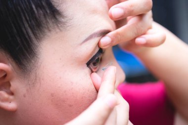 Kadınlar miyoplara yardım etmek için lens takıyorlar. Yakın çekim..