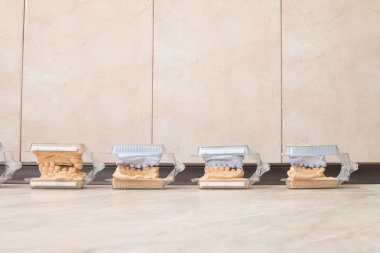 Diş döküm alçı modelleri alçı