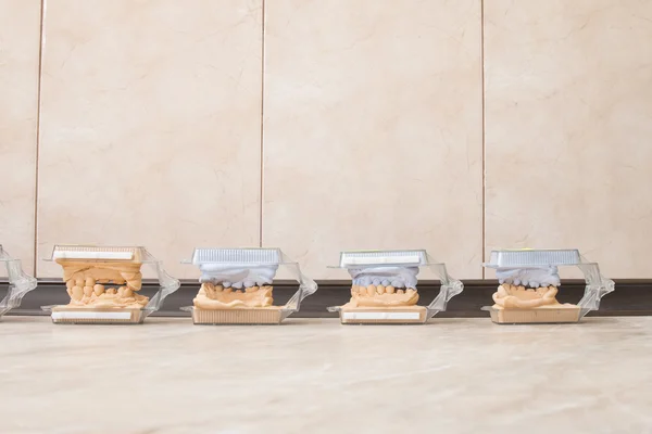 Diş döküm alçı modelleri alçı