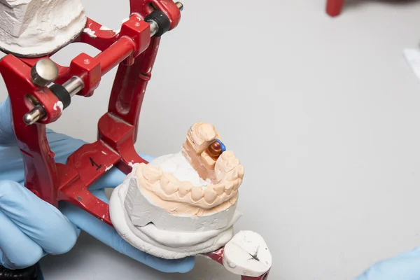 Dental technician showing tooth dentures — Stock Photo, Image