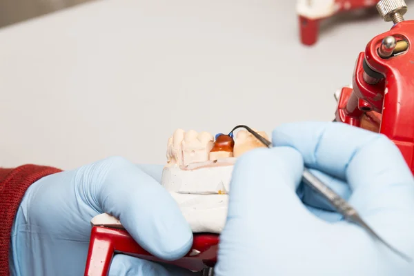 elinde bir diş implantı üzerinde çalışan diş hekimi