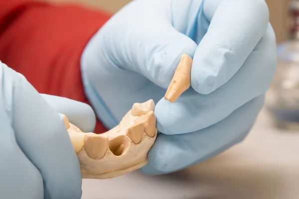 elinde bir diş implantı üzerinde çalışan diş hekimi