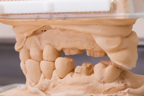 Modèle de gypse dentaire moule de dents en plâtre Images De Stock Libres De Droits