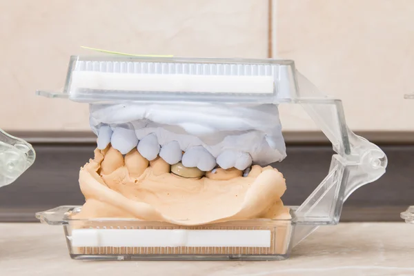Dental casting plâtre modèles de gypse Image En Vente