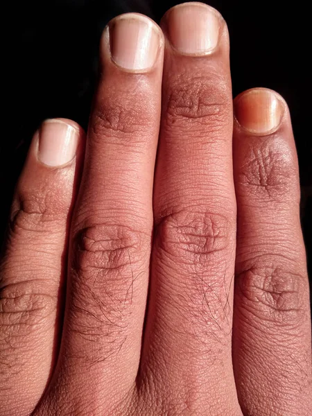 closeup of four fingers of left male hand together on a black background