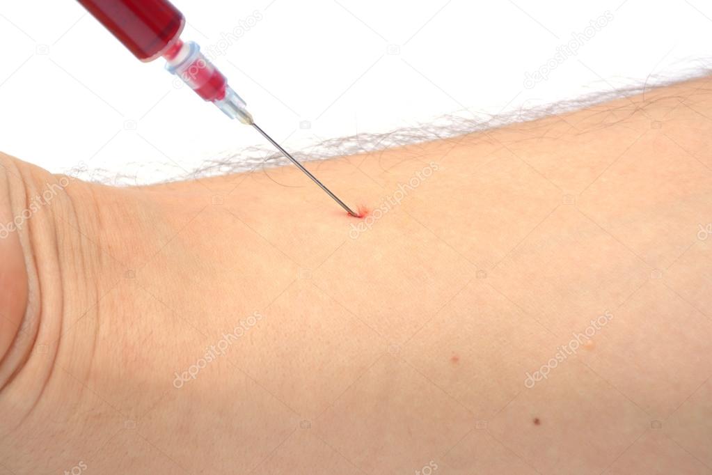 Blood sampling with syringe and needle for analysis