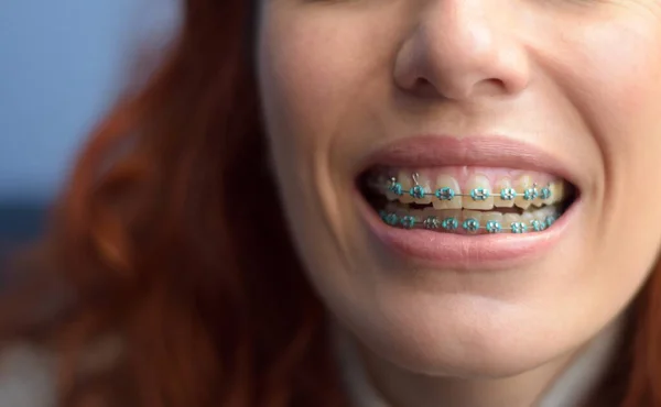 Gülümseyen ağız, mavi arka planda kızıl saç telleri.