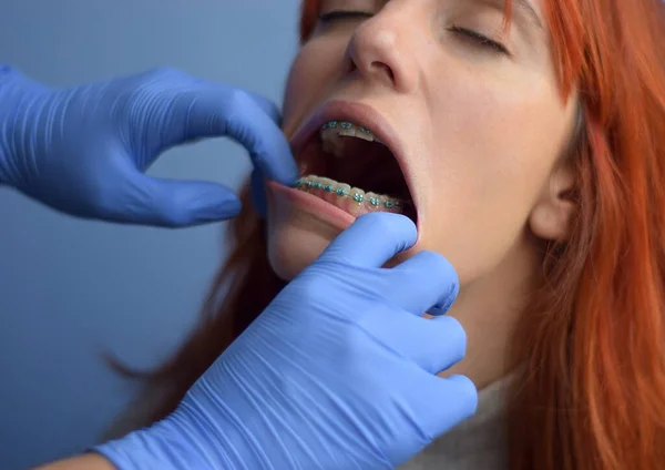 Doctor opens the woman\'s mouth with his hands to check her brackets and pulls her lips out.