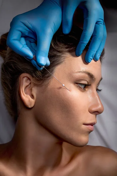 Cirugía de lifting facial . —  Fotos de Stock