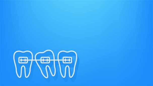 Correção dos dentes com aparelho ortodôntico. Estágios de alinhamento dos dentes. Serviços de clínica dentária. Gráficos de movimento. — Vídeo de Stock