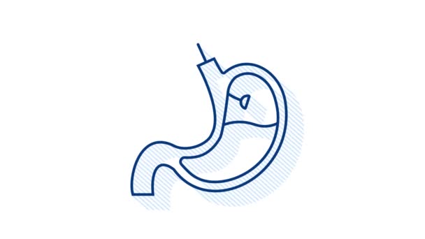 Endoscopia estomacal. Endoscopio en el estómago a través del esófago. Gráficos en movimiento. — Vídeo de stock