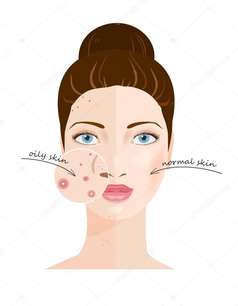 Skin types. Vector Stock Vector Image by ©Olesssia #68835519 Skin types. Vector Stock Vector Image by ©Olesssia #68835519