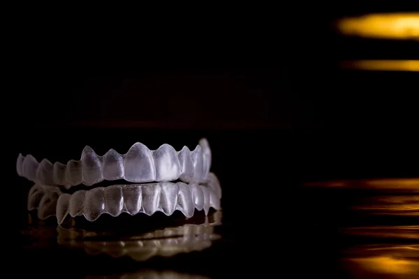 Ortodoncia invisible para prótesis dentales — Foto de Stock