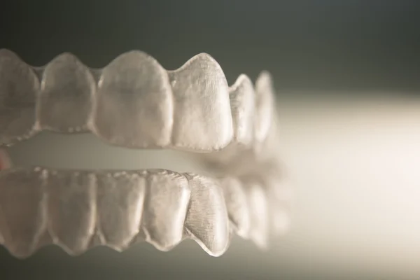 Denti dentali invisibili staffe allineatori dentali bretelle in plastica — Foto Stock