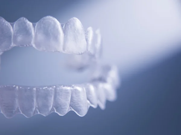 Závorky neviditelný zubní zuby zubní aligners plastovými výztuhami — Stock fotografie