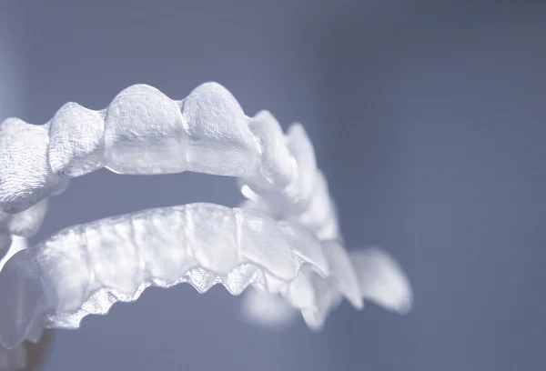 Wsporniki zębów dentystycznych niewiem ząb korekcyjnych plastikowe klamry re — Zdjęcie stockowe