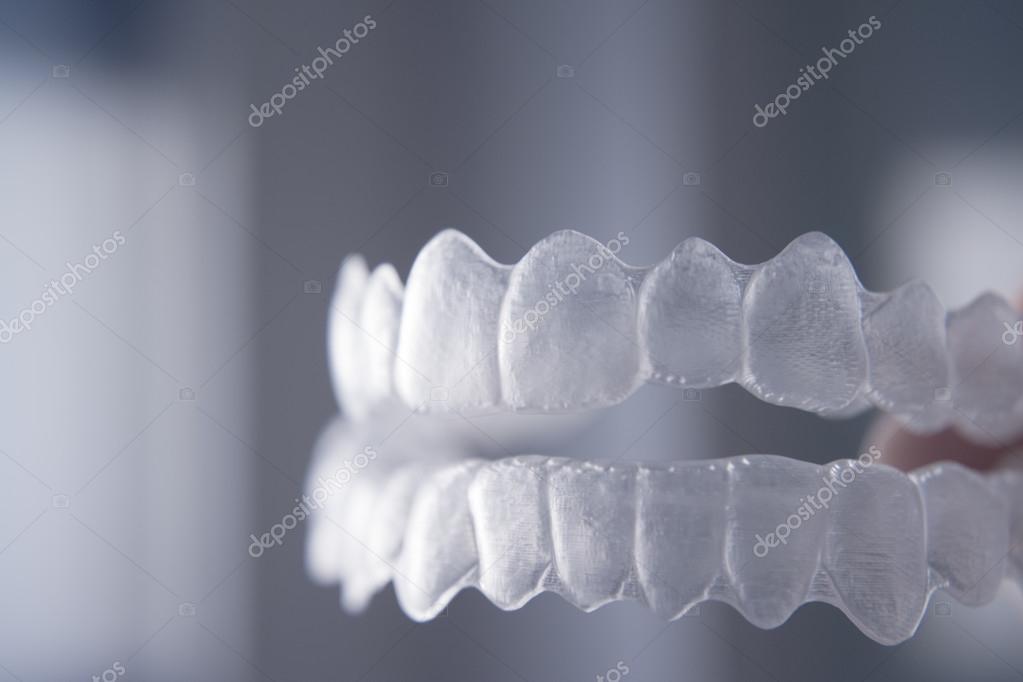 bracket invisibles bracket invisibles