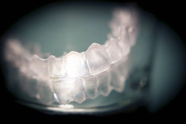 Przezroczysty Wyrównujący Zęby Kryształowej Szklance Żadnych Ludzi — Zdjęcie stockowe