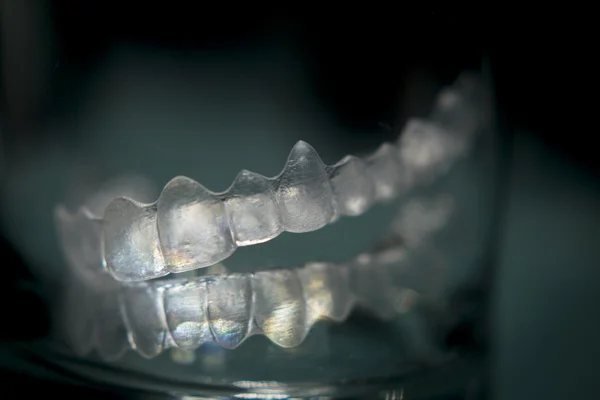 目に見えない歯歯ブラケット歯プラスチック中かっこ — ストック写真