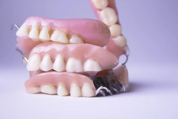 Limpeza interdental. Higiene dentária — Fotografia de Stock