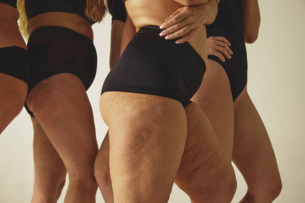 Women bodies close up in black underwear on studio background. Concept of body confidence, real skin texture, inclusive beauty standards, skincare honesty, wellness promo, and cosmetic brand marketing