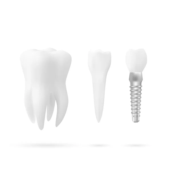 Conjunto de dientes de árbol — Archivo Imágenes Vectoriales