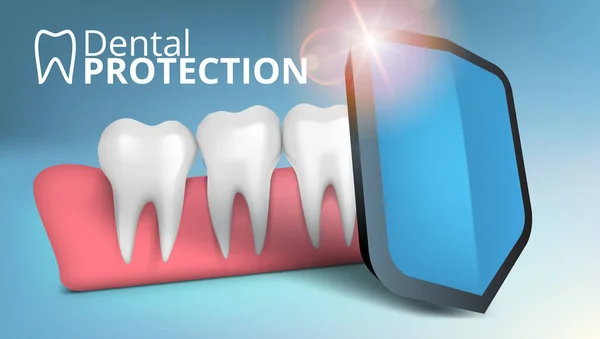 Plantilla de protección de caries de escudo dental 3D — Archivo Imágenes Vectoriales