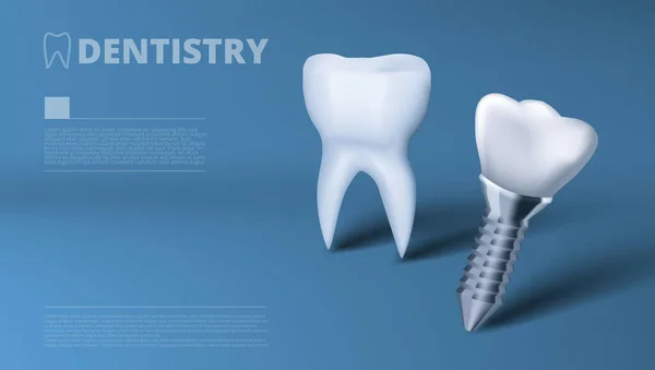 Anuncio de clínica de implantes dentales y dientes saludables — Archivo Imágenes Vectoriales