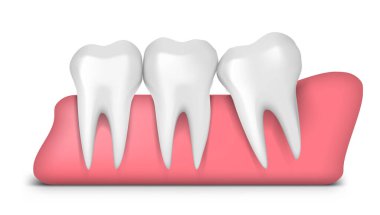 3 Boyutlu Bilgelik Mesyal Etki Sorunu