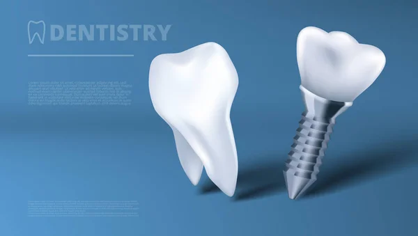 Anuncio de clínica de implantes dentales y dientes saludables — Archivo Imágenes Vectoriales